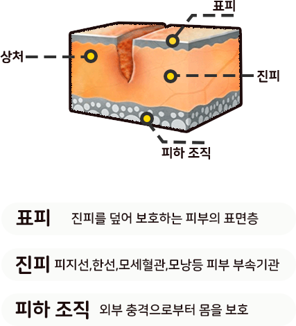 흉터 형성 과정