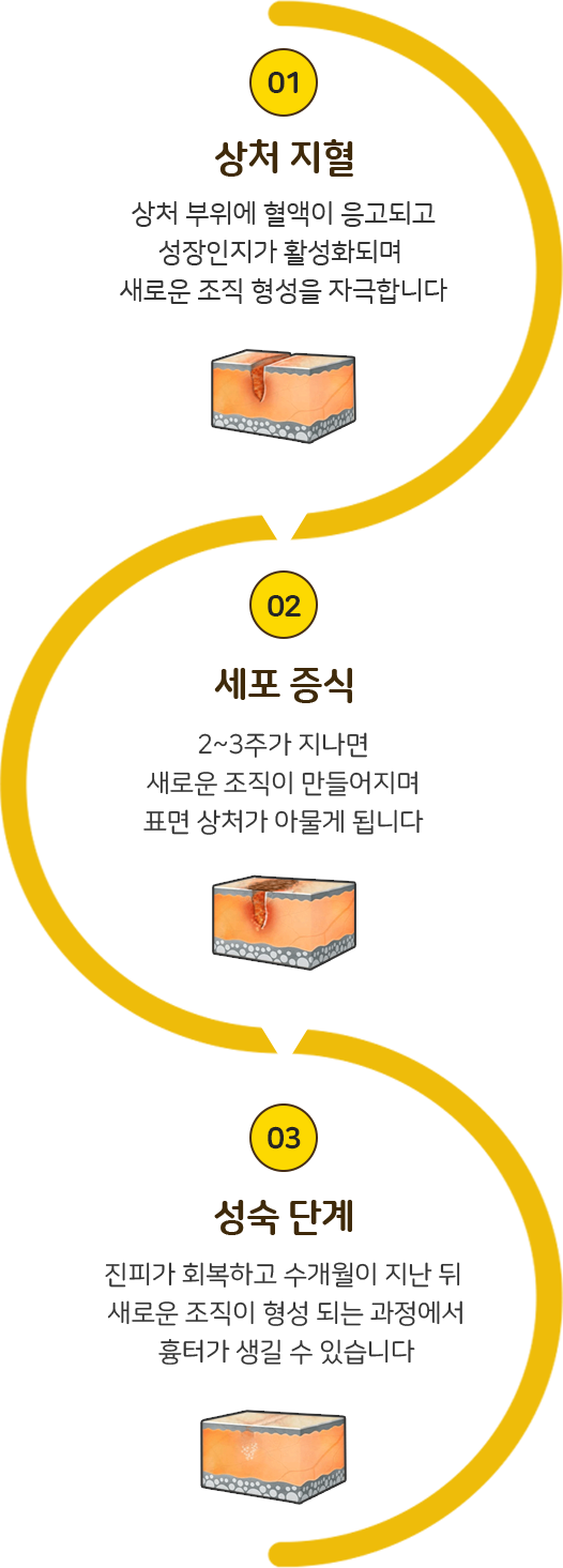 흉터 형성 과정