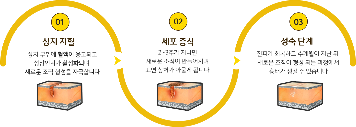 흉터 형성 과정